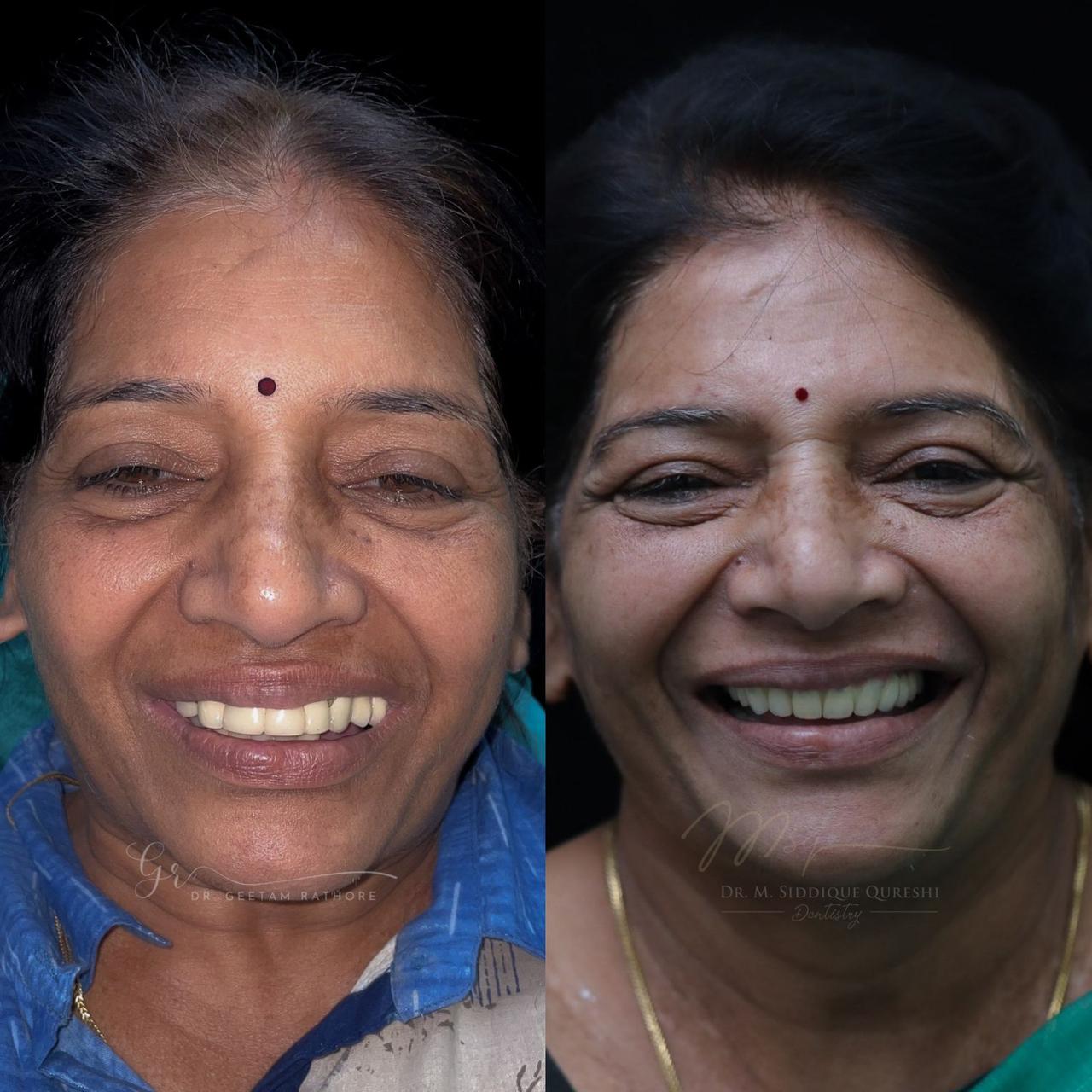 Senior Care Rehab