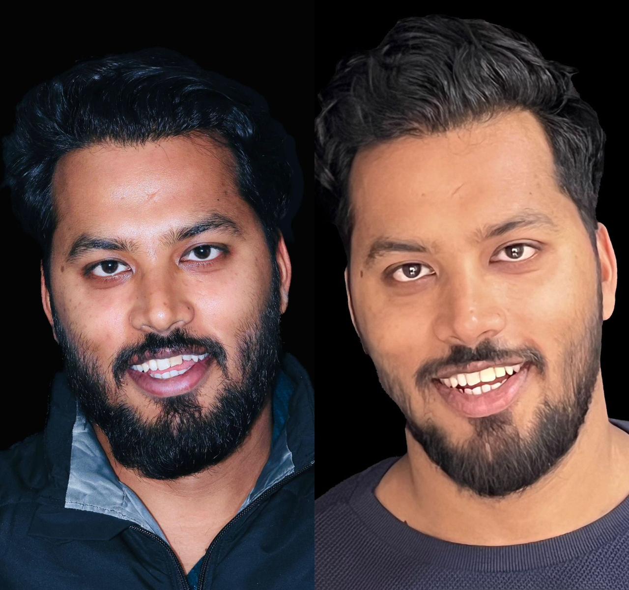Aesthetic Restoration
