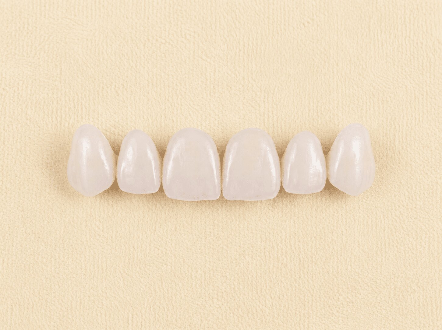 Veneers